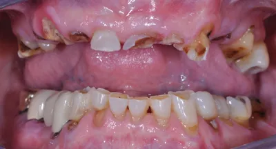 Before dental treatment