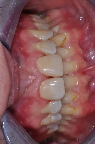 After dental treatment