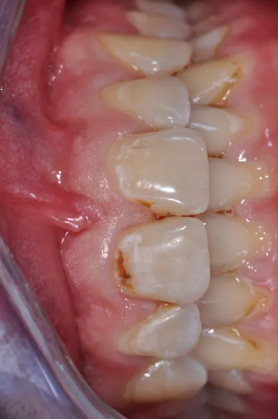 Before dental treatment